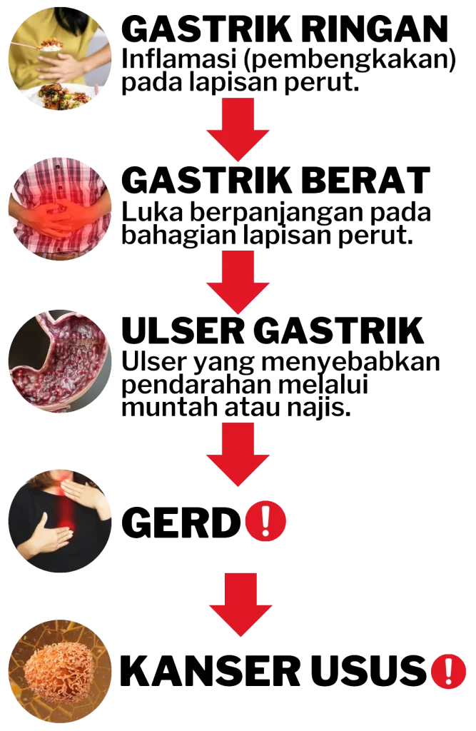 Sebelum - Masalah Angin Teruk & Gastrik